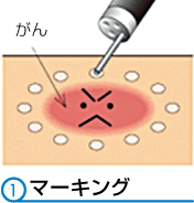 esd_ޡ